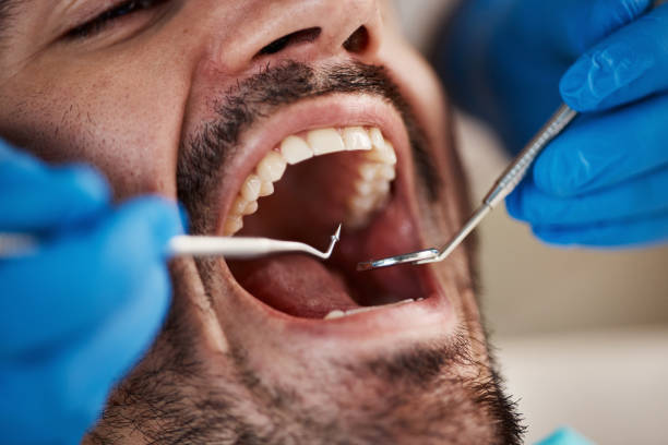 Best Urgent Tooth Repair  in Avery Creek, NC